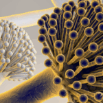 Hospital Air Purifiers Case Study